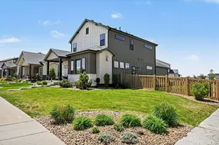 5177 School House Dr, Timnath, CO 80547 - Photo 1