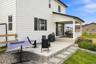 965 Sandhills St, Windsor, CO 80550 - Photo 27