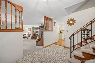5 Andrew Ln, Schaumburg, IL 60193 - Photo 3