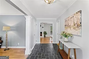 5513 N Peachtree Rd, Dunwoody, GA 30338 - Photo 5