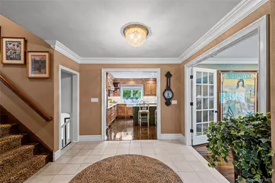 11 Hickory Road, Woodmere, NY 11598 - Photo 3