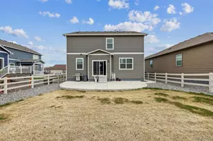 4731 Rosette St, Castle Rock, CO 80104 - Photo 29