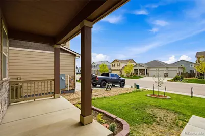 532 2nd Street, Severance, CO 80546 - Photo 3