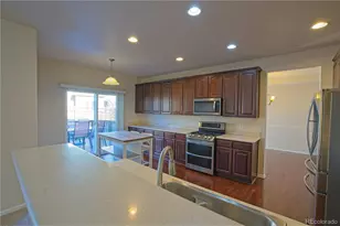 7418 Grady Cir, Castle Rock, CO 80108 - Photo 5