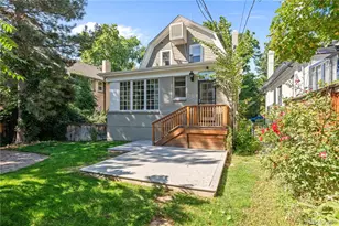 570 N Gilpin St, Denver, CO 80218 - Photo 3