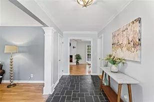 5513 N Peachtree Rd, Dunwoody, GA 30338 - Photo 5